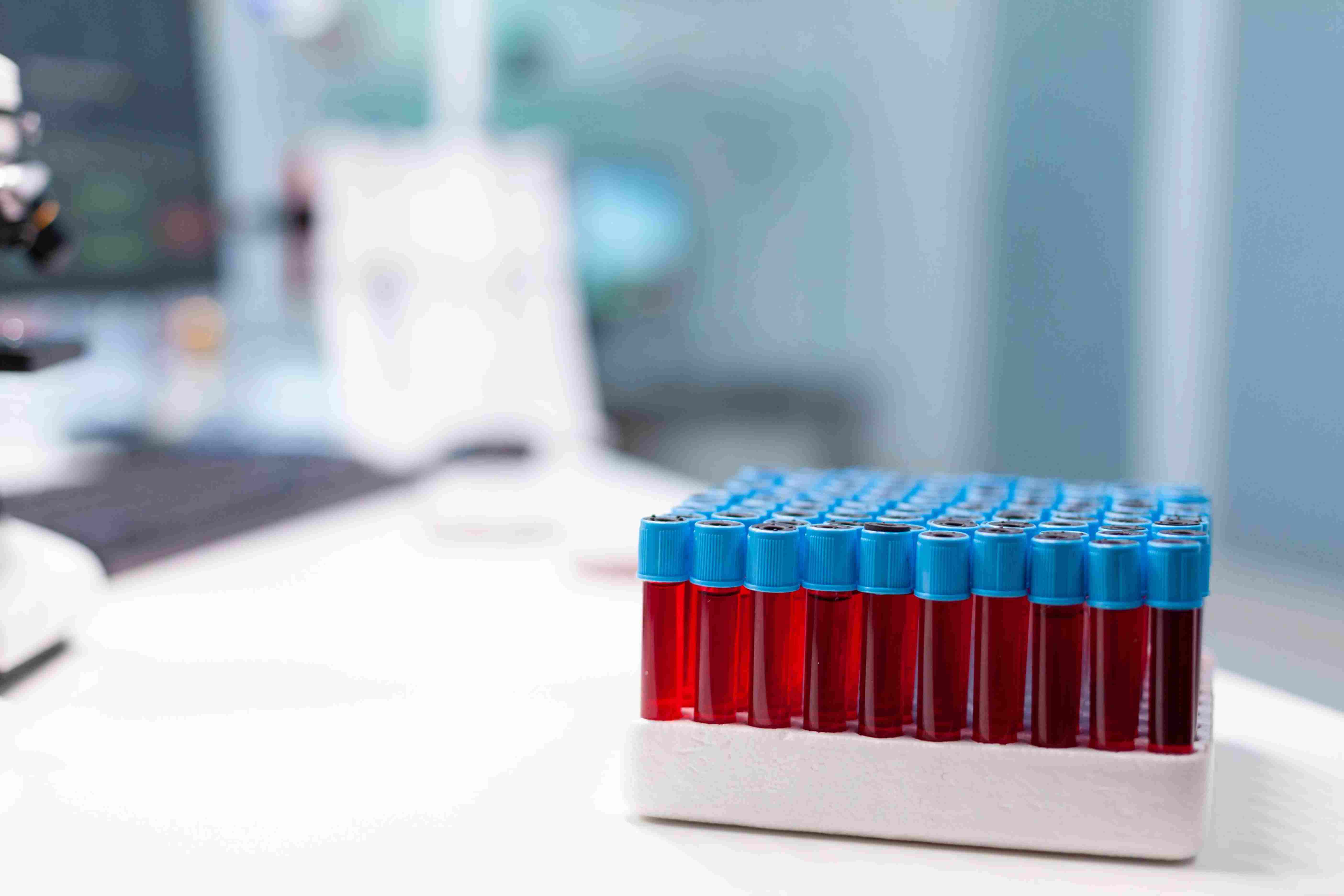 The Laboratory Behind Every Safe Maternal Blood Transfusion When Postpartum Haemorrhage Happens